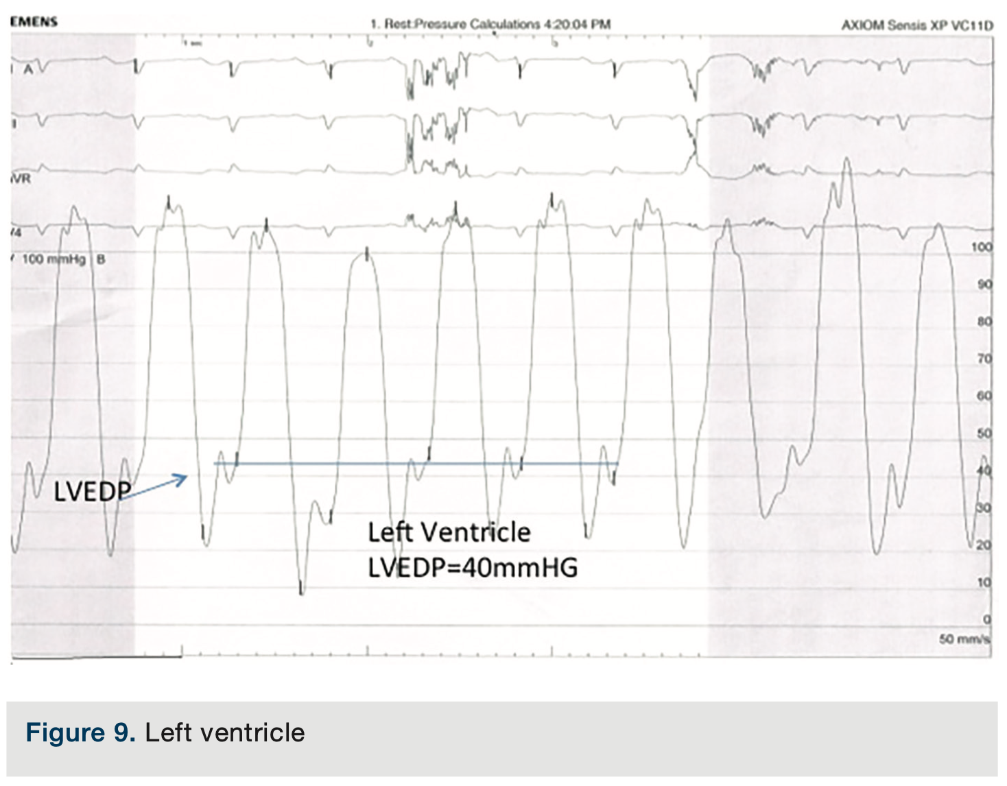 Merschen HemodynamicsPart2 Figure 9