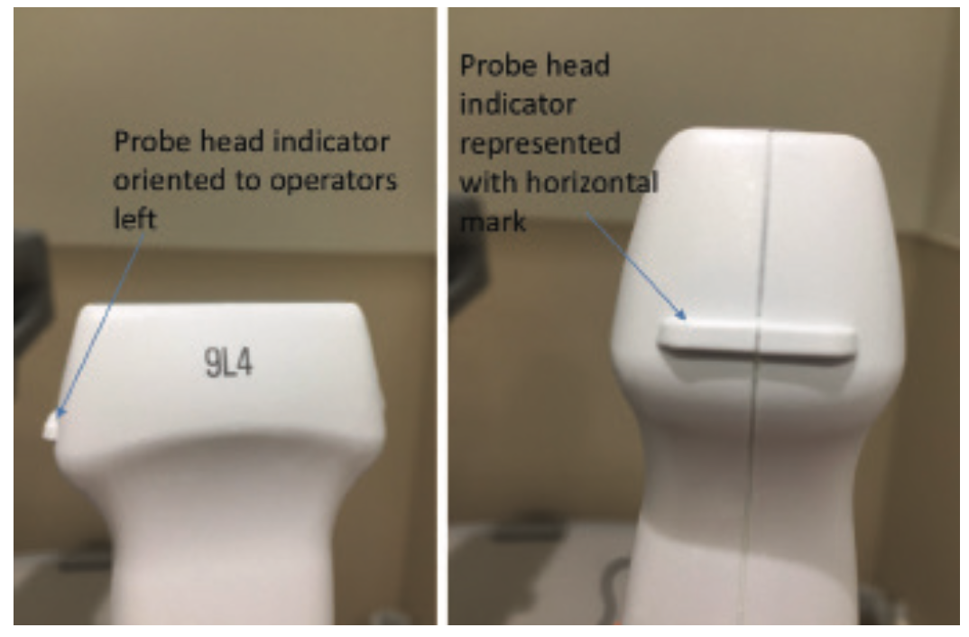 Merschen Vascular Access Figure 4