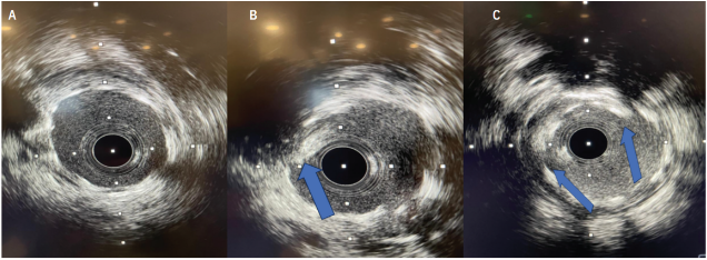 Merschen-Fig4-CLD-SeptOct 2026.png 