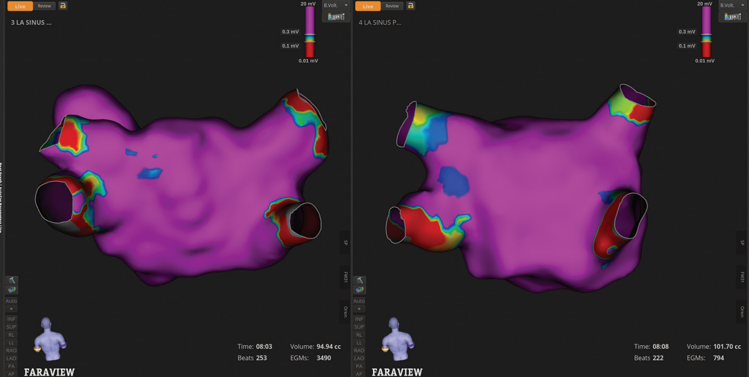 Meyers-Fig1-EPLD-July 2025_0.png 