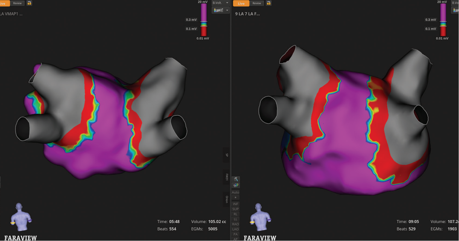 Meyers-Fig2-EPLD-July 2025_0.png 