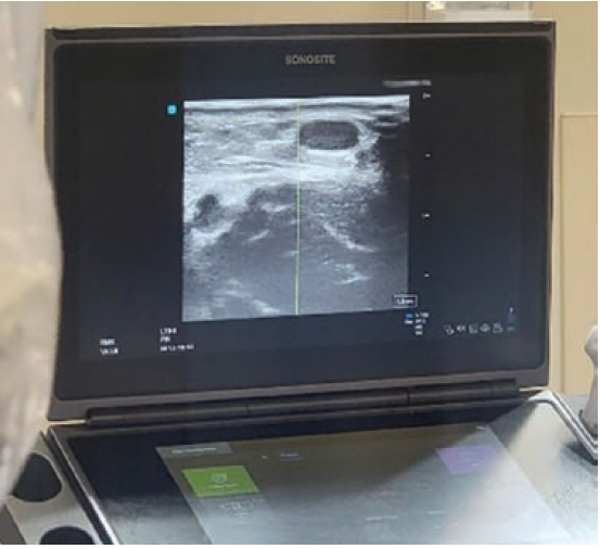 Miranda-Fig-CLD-April 2025.png 