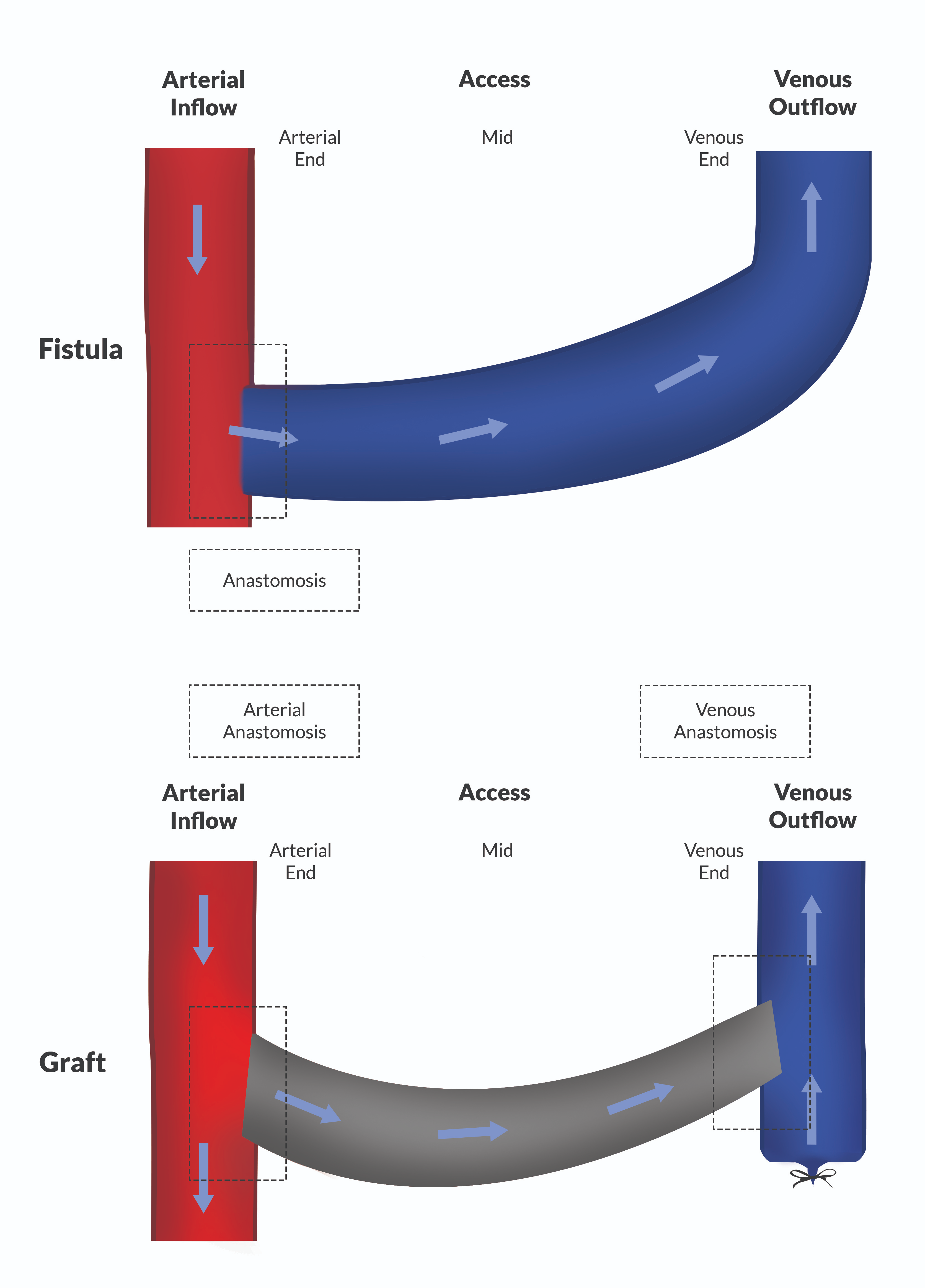 Misono CLD April Figure 1
