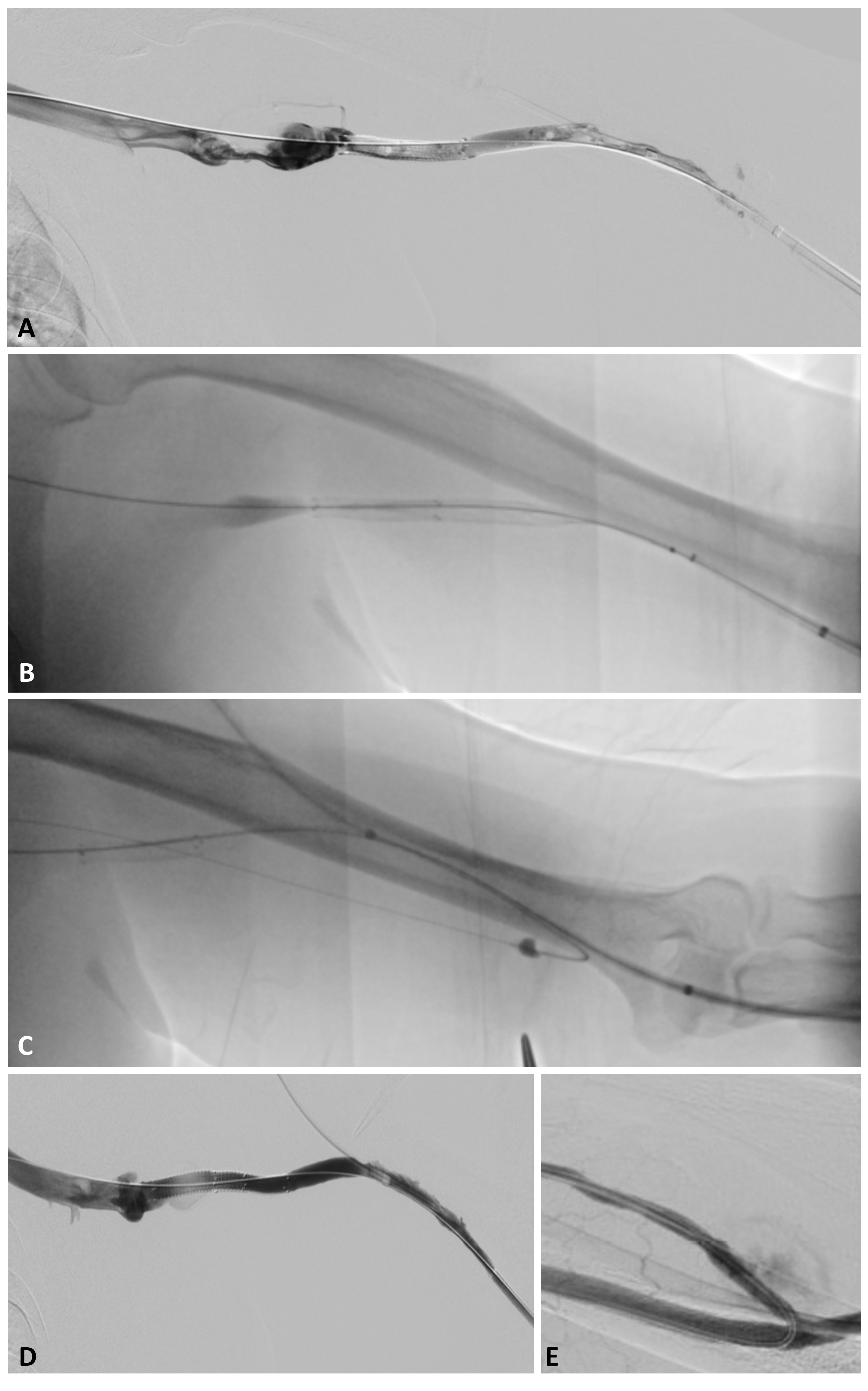 Misono CLD April Figure 4