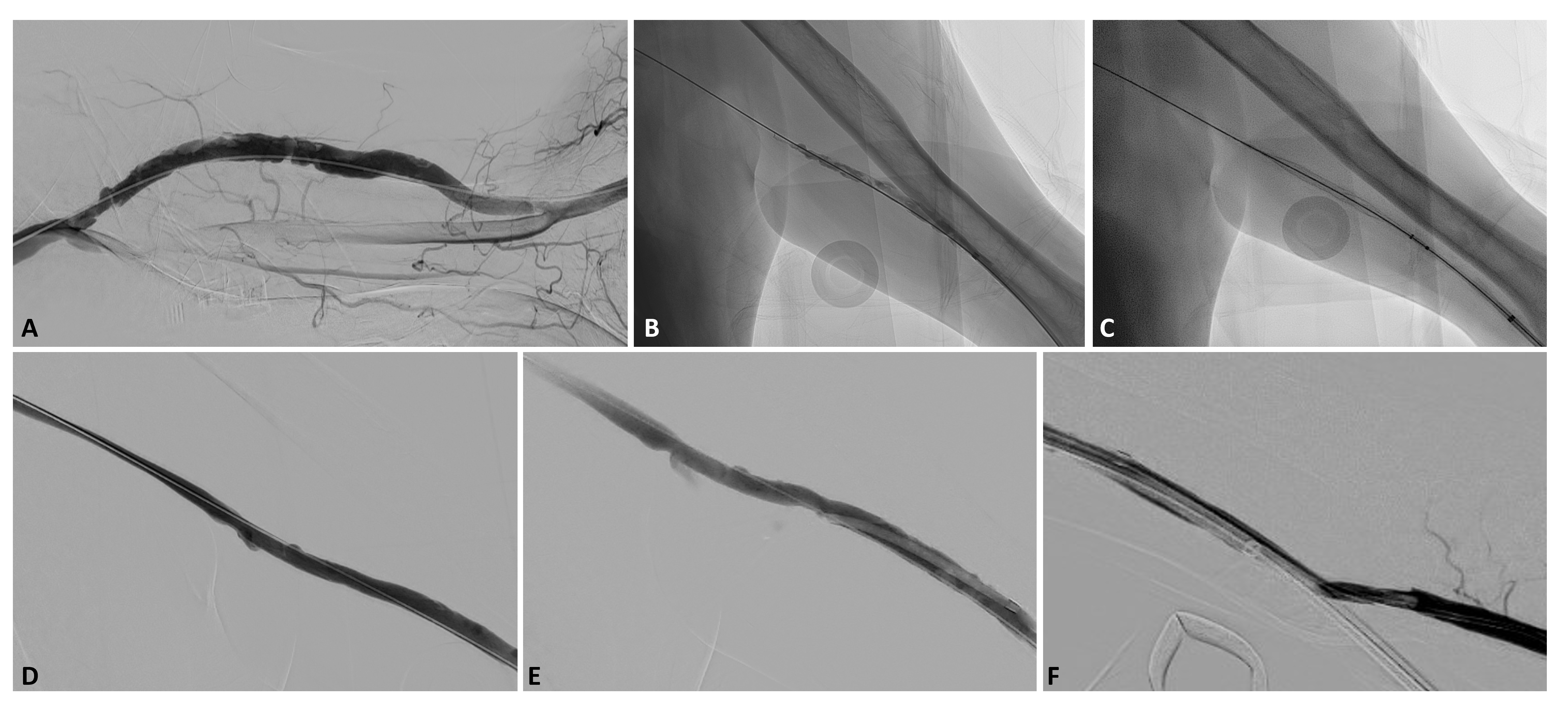Misono CLD April Figure 5