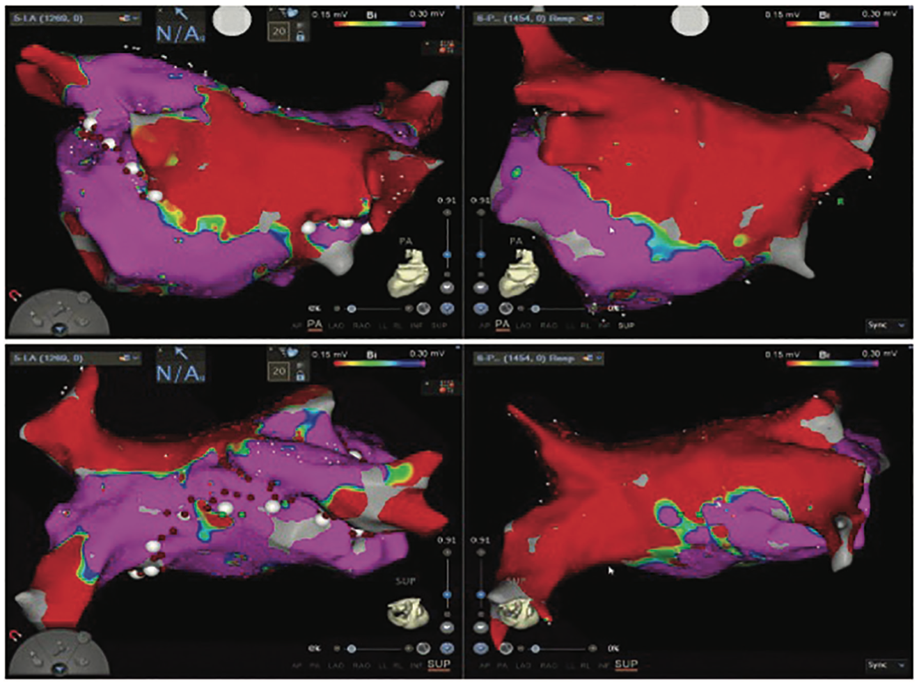 Morris Hybrid Ablation Figure 1