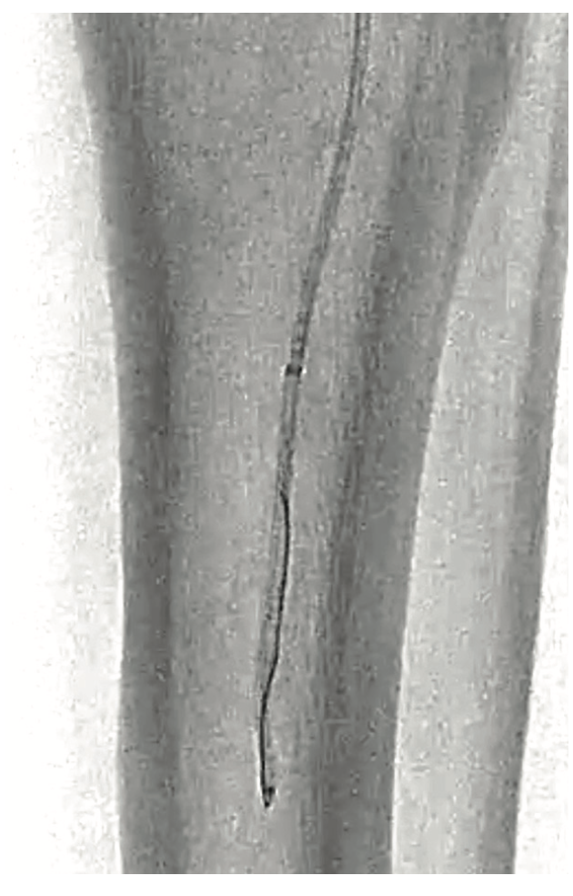 Mustapha Plantar Circulation Figure 1