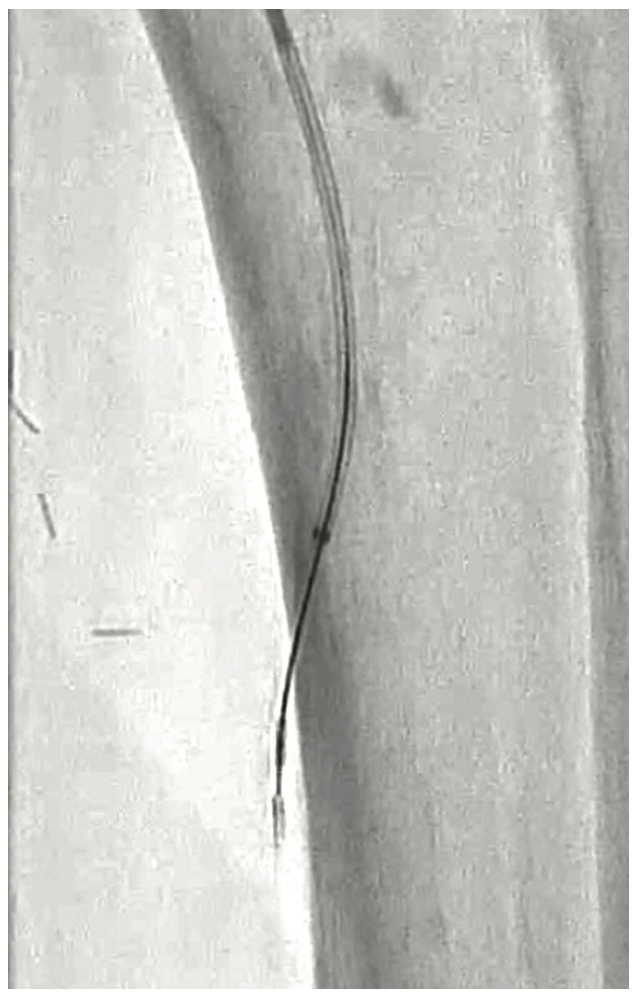 Mustapha Plantar Circulation Figure 4