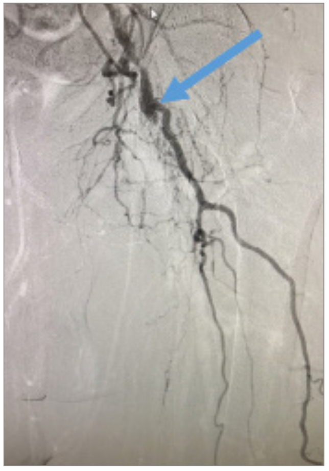Nagel CTO Crossing Figure 1