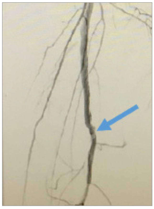 Nagel CTO Crossing Figure 10
