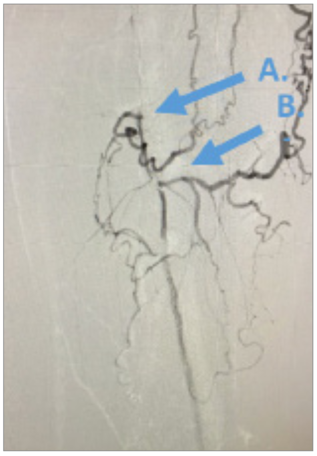 Nagel CTO Crossing Figure 2