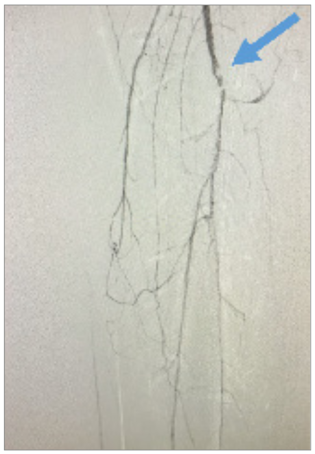 Nagel CTO Crossing Figure 3