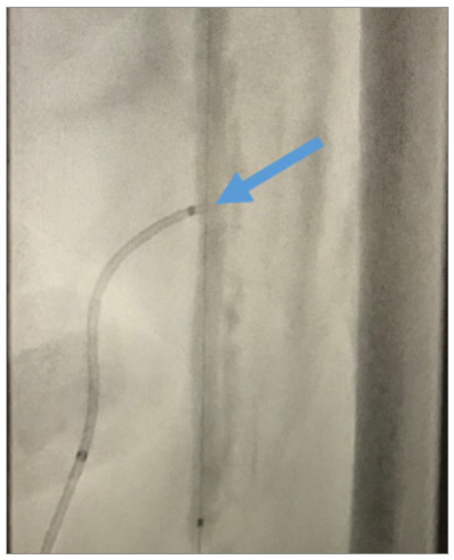 Nagel CTO Crossing Figure 5