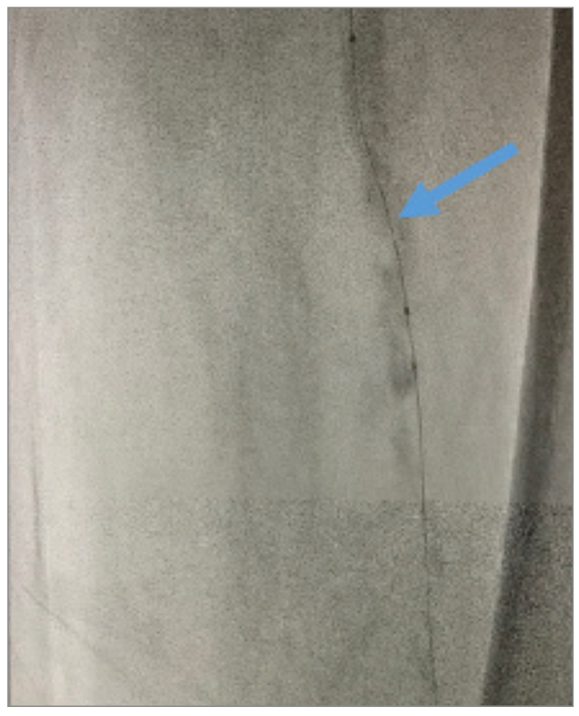 Nagel CTO Crossing Figure 6