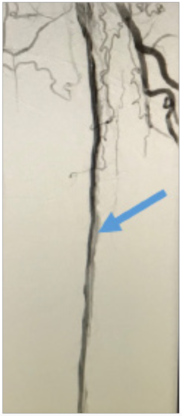 Nagel CTO Crossing Figure 7