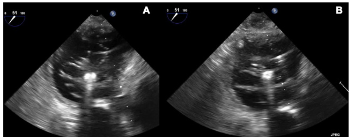Nerla TriClip Figure 1