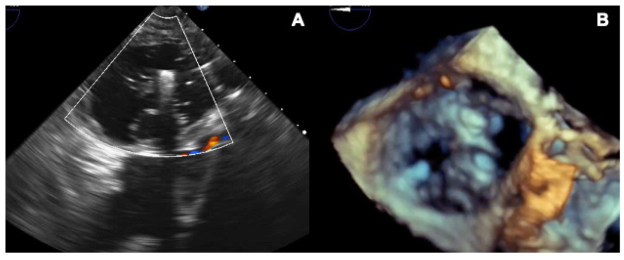 Nerla TriClip Figure 2