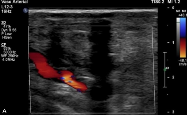 Figure 2A
