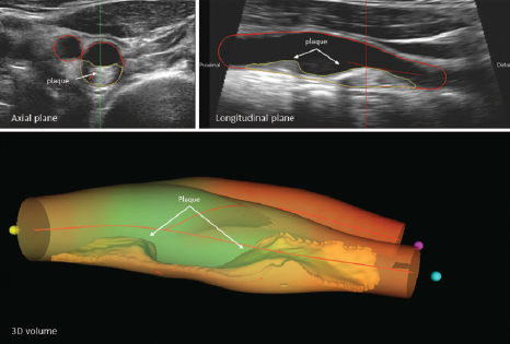 News - Figure - CLD - Nov 2024 