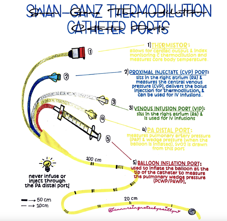 Nichols Figure 3 Swan Ganz