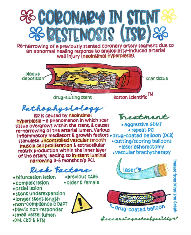 Nichols Figure 6 Coronary Instent Restenosis