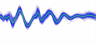 How a Simple Headset Can Solve the Triage Problem in Stroke