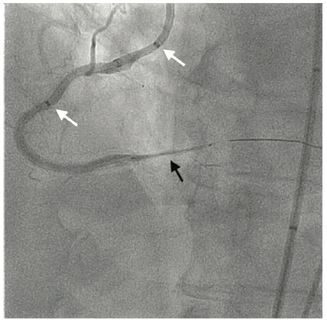 Oleszak Guidewire Figure 3