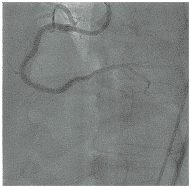 Oleszak Guidewire Figure 5