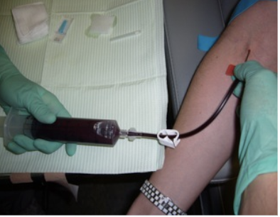 Options also exist with biologics such as platelet-rich plasma. 