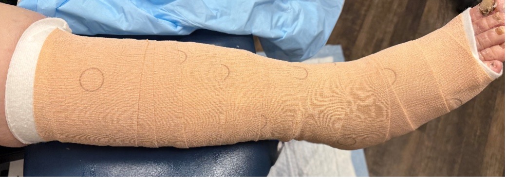 Figure 1. Example of a multicomponent compression system