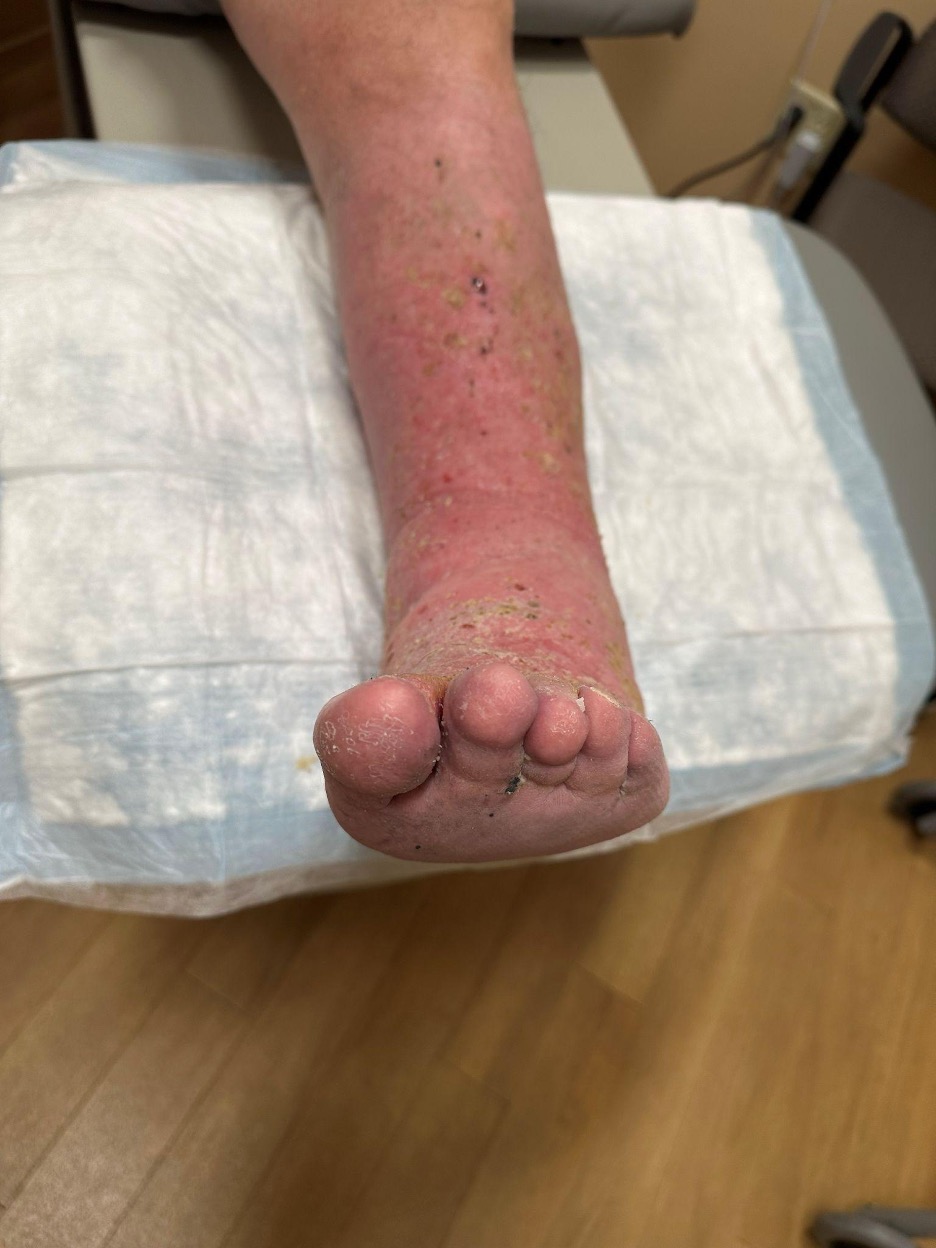Figure 10. Additional view 11 months postop.