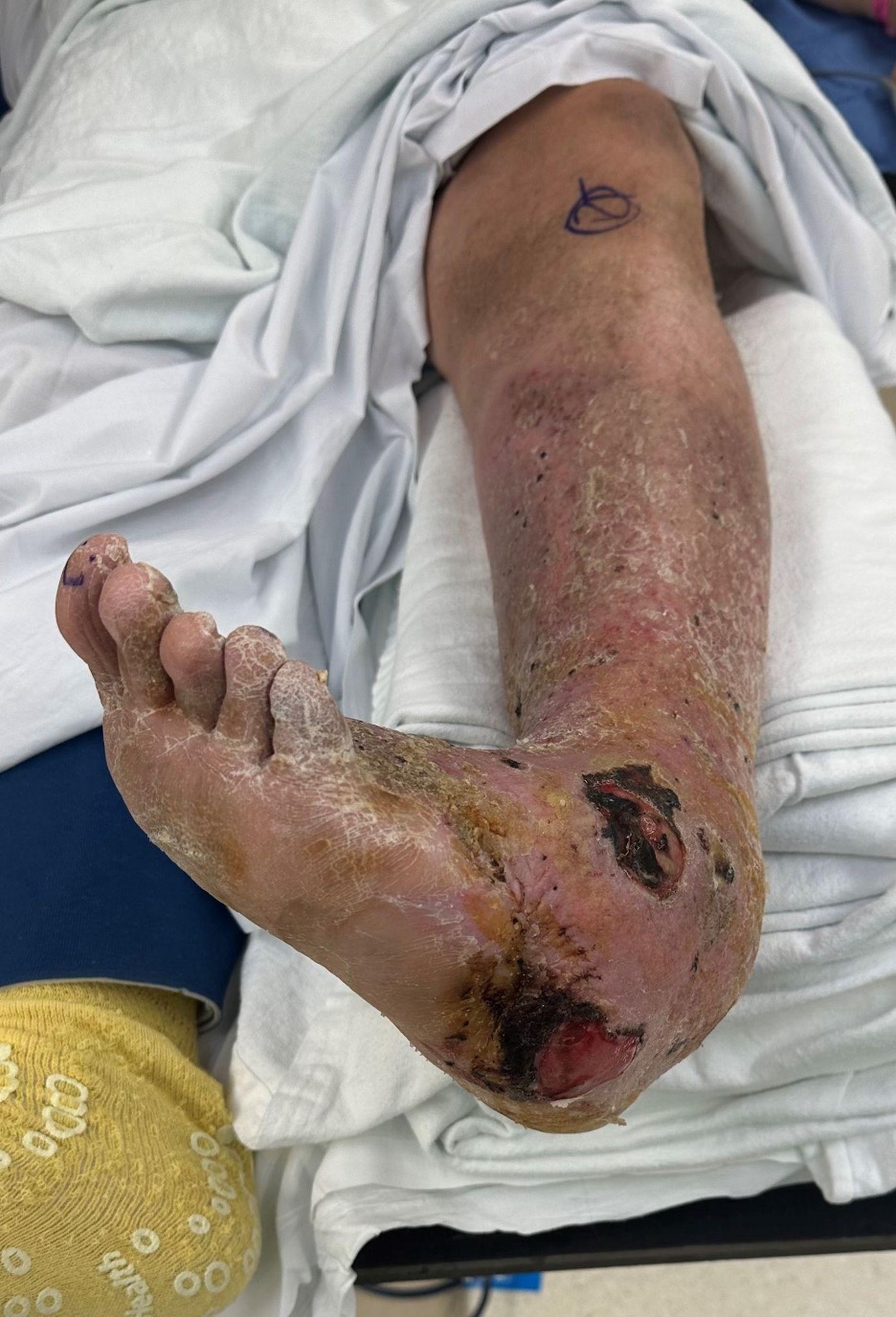 Figure 2. Additional preoperative clinical photo.