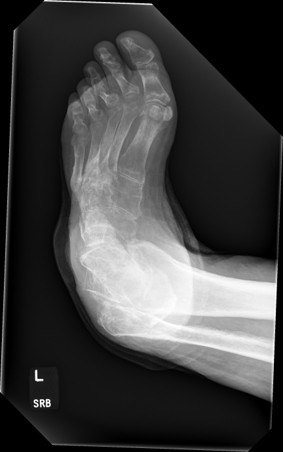 Figure 4. Additional preoperative image. 