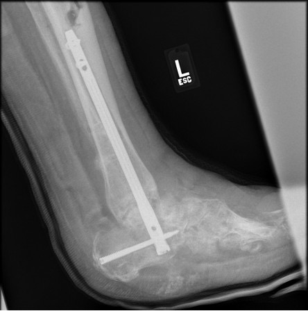Figure 6. Additional postoperative image from same interval as previous image.