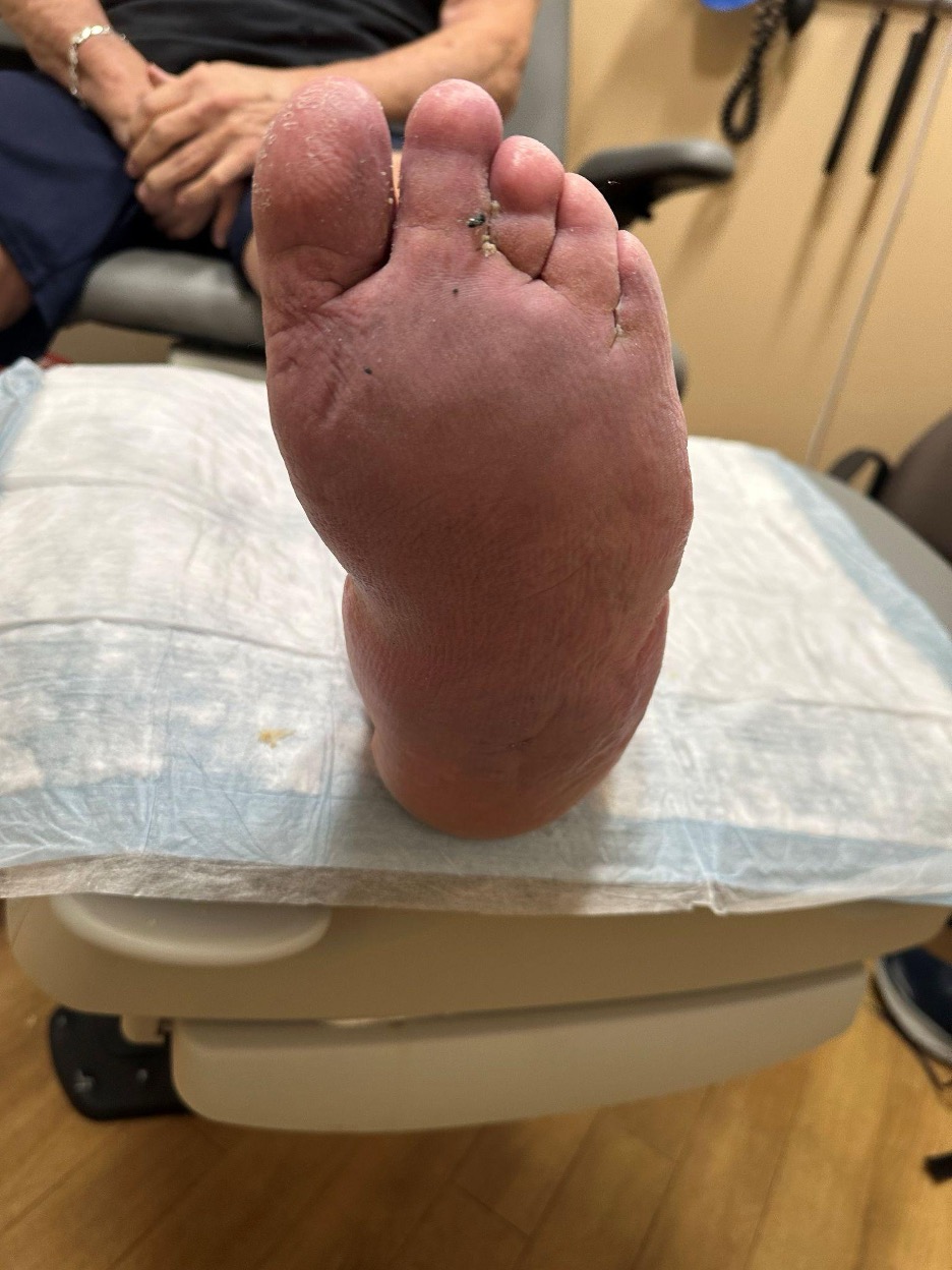 Figure 8. This photograph reflects the status 11 months postoperatively.