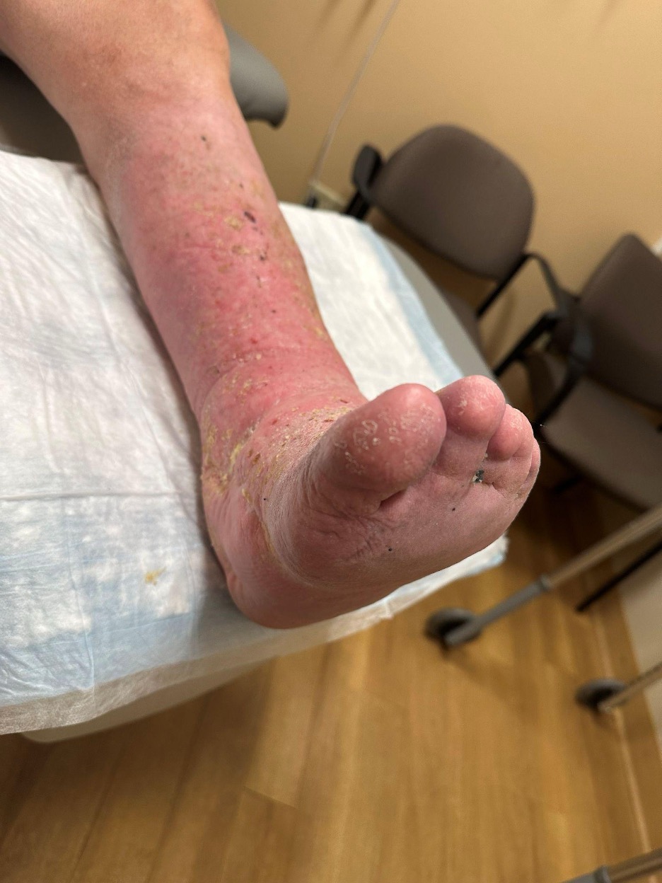 Figure 9. Additional view 11 months postop.