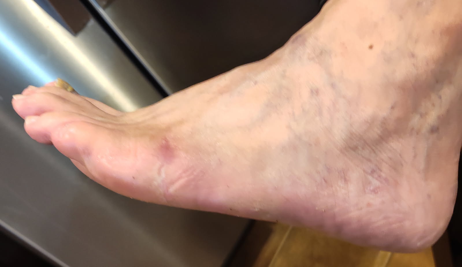 Figure 6. Here is the final result of treatment. 