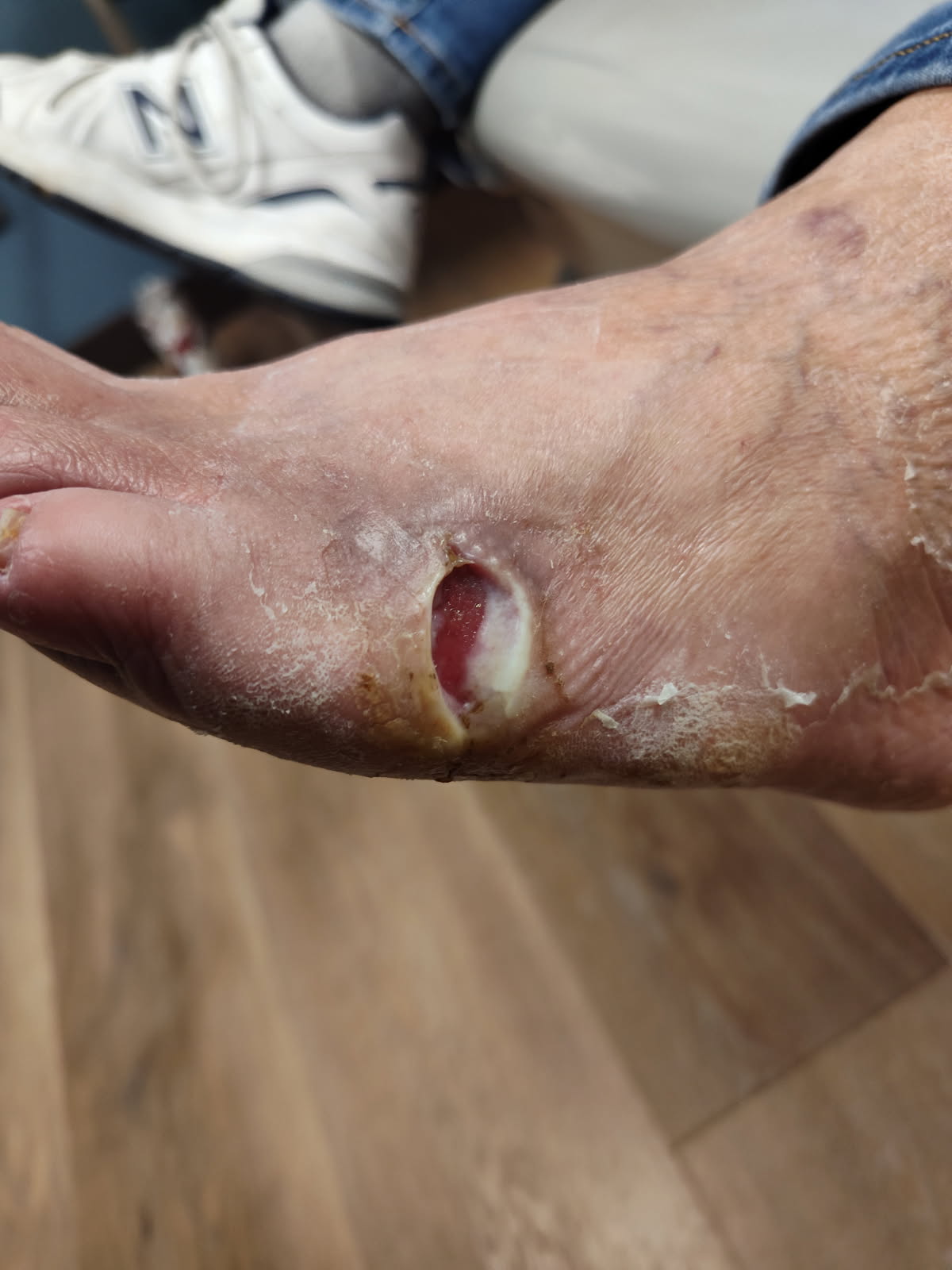 Figure 4. Here is the wound at week three of treatment. 