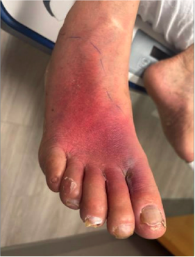 Figure 1. Initial patient presentation. 