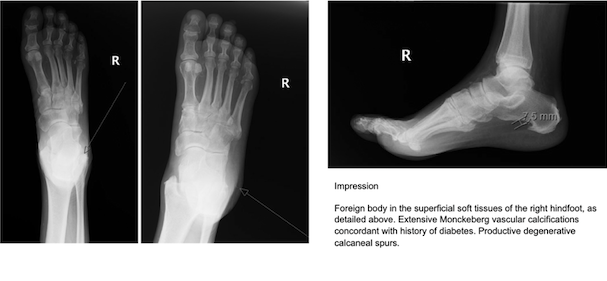 Figure 2. Radiographic imaging of the foot. 