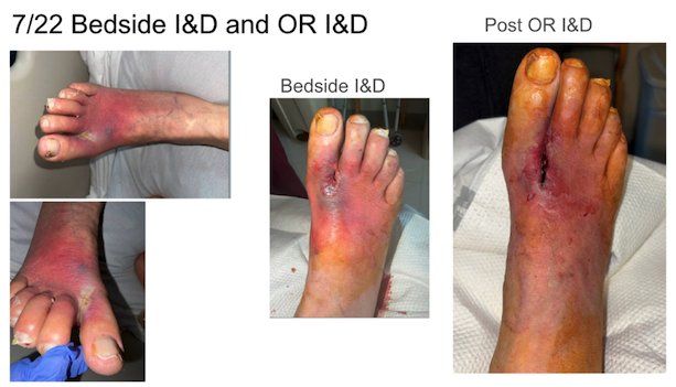 Figure 3. Post-debridement imaging. 