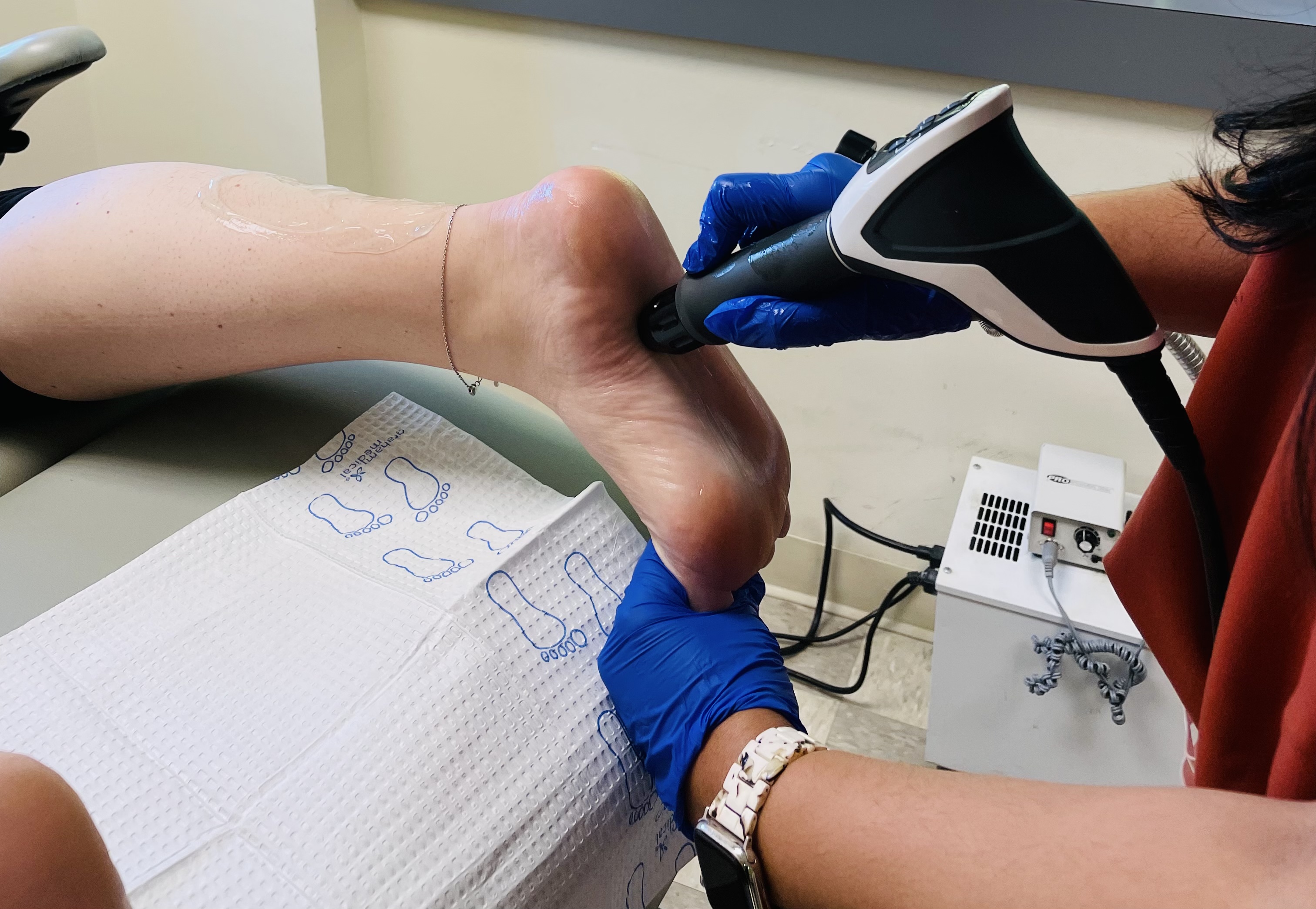 Figure 1. Malay and colleagues found that ESWT was both effective and safe for chronic proximal plantar fasciitis.19 