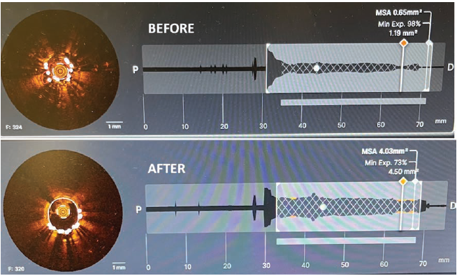 Patel Fig 2 July 2024