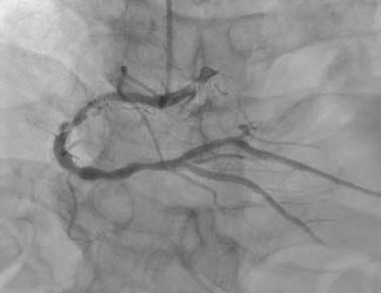 Patel-Fig1-CLD Nov 2025.png 