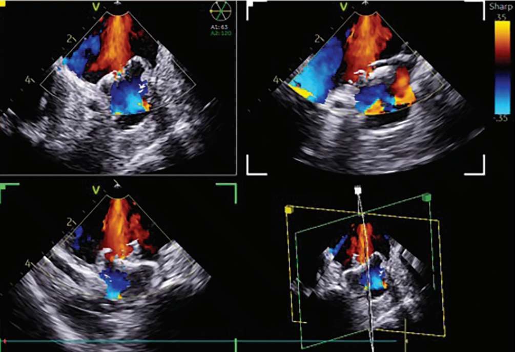 Patel-Fig1-EPLD-Sept 2025.png 