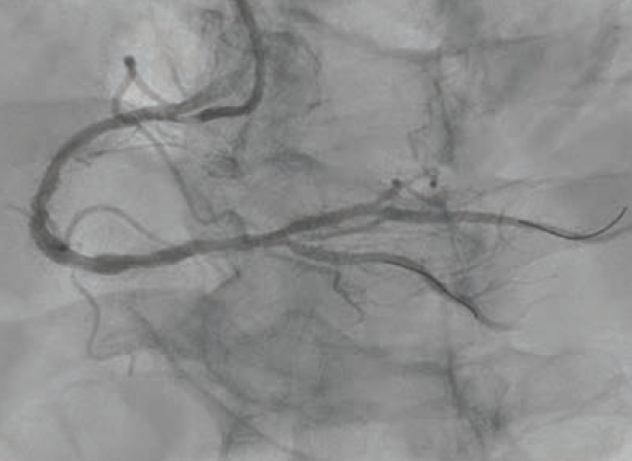 Patel-Fig2-CLD Nov 2025.png 