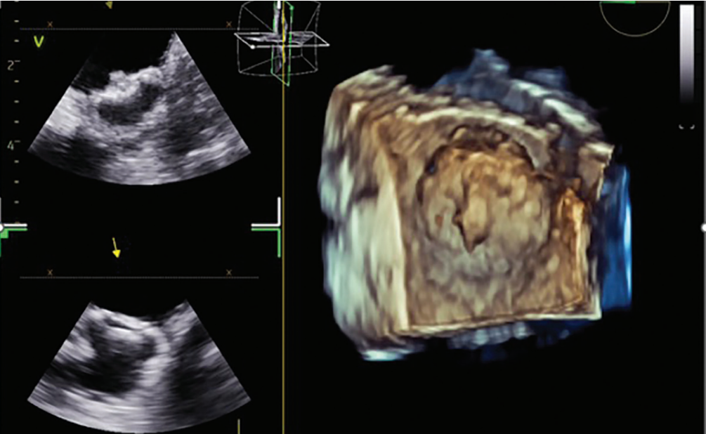 Patel-Fig2-EPLD-Sept 2025.png 