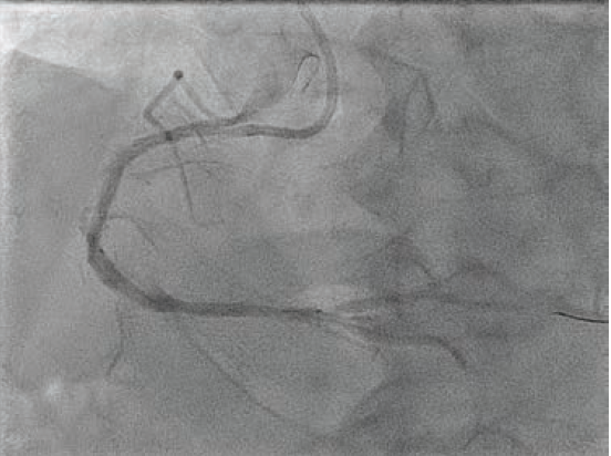 Patel-Fig4-CLD Nov 2025.png 