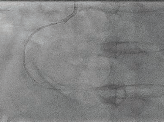 Patel-Fig5-CLD Nov 2025.png 