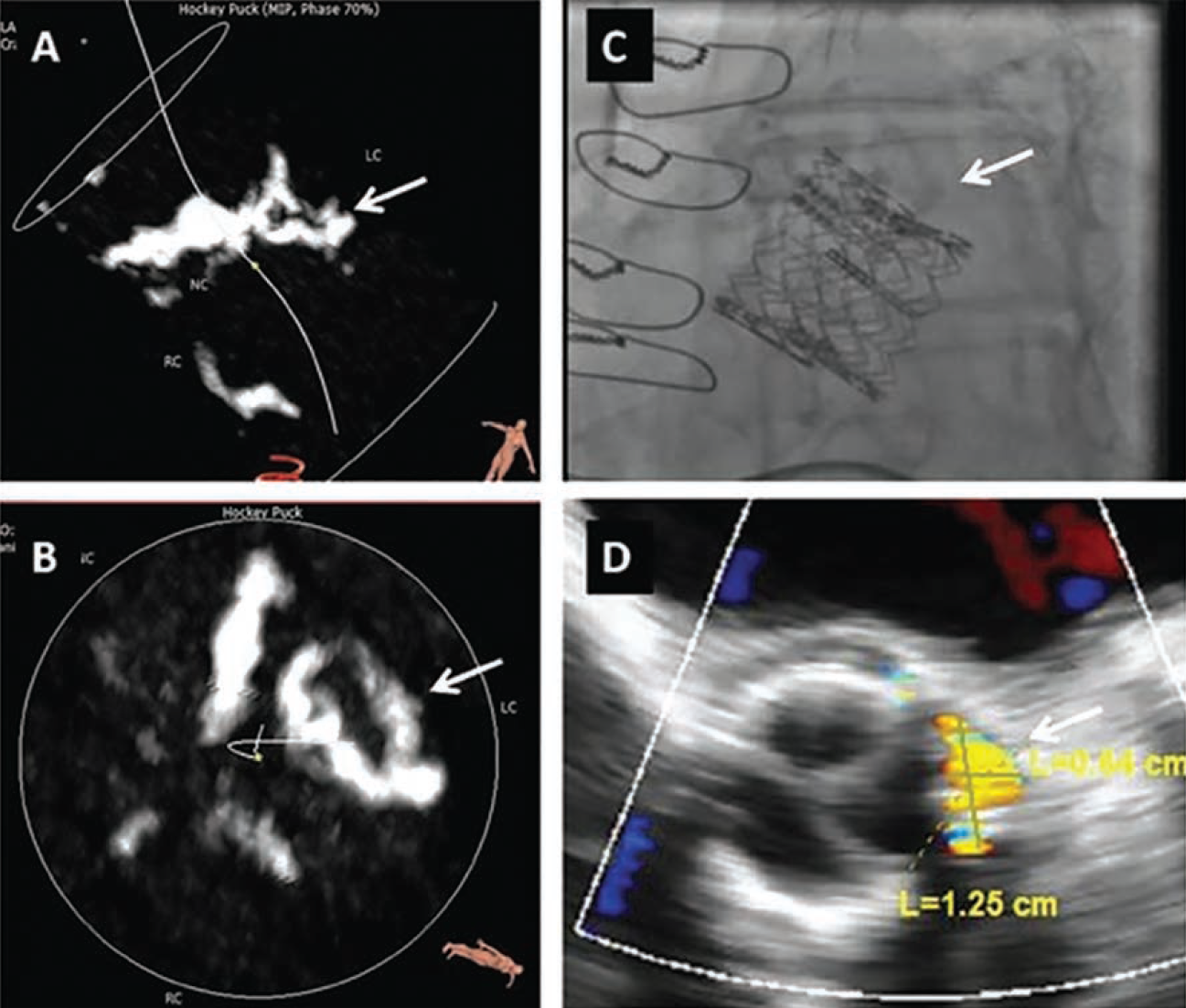 Patel-Figure-CLD-Dec2024